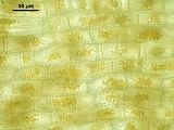 Cellule corticali in visione superficiale